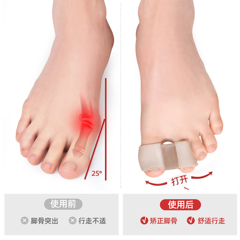 Cross-border Hallux Valgus Toe Separator Thumb Separator Big Foot Bone SEBS Elastic Toe Cover