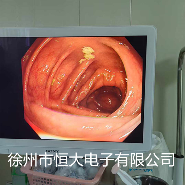 Olympus Gastrointestinal Endoscope Cv-1500 Electronic Gastroscopy Gif-H290 Electronic Colonoscopy Cf-H290I