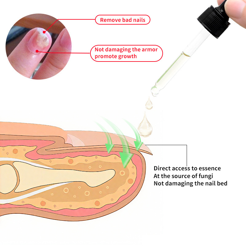 Cross-Border Full English Ginger Nail Care Solution Nail Care Hand and Foot Nail Moisturizing Care Solution Spot Wholesale