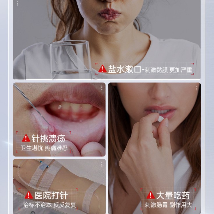 Class Ii Medical Device Medical Oral Ulcer Gargle to Relieve Oral Inflammation Mouthwash Periodontal Inflammation Oem