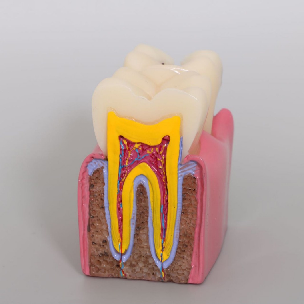 Production oral model dental model dental cavity section demonstration teaching dental model dental 6 times dental cavity comparison model