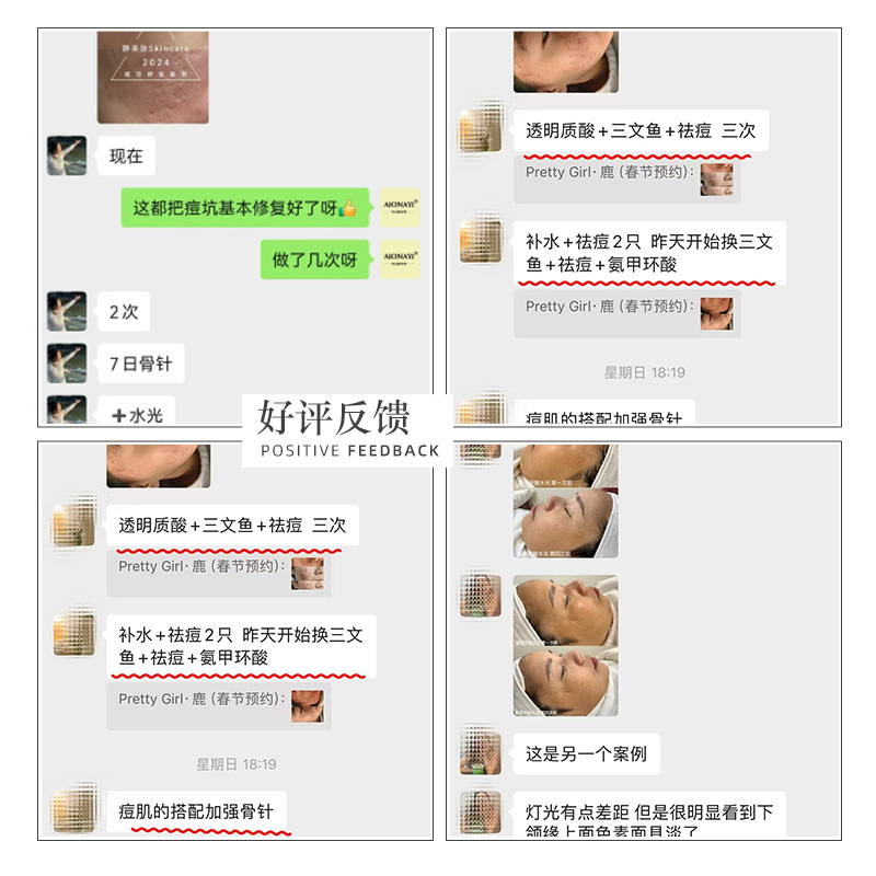 Beauty Salon 99%7 days sponge bone needle anti-acne marks acne pit delicate pores seaweed silicone needle sponge Micro Needle