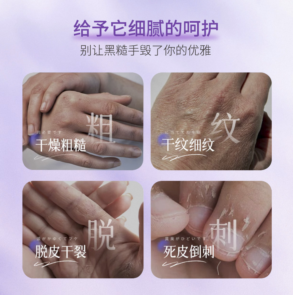 Hand and Foot Luxury Nourishing Skin Care Set, Customized Processing, Hydrating and Moisturizing Hand Mask, Hand Care Essence, Hand Care Kit, Cosmetics