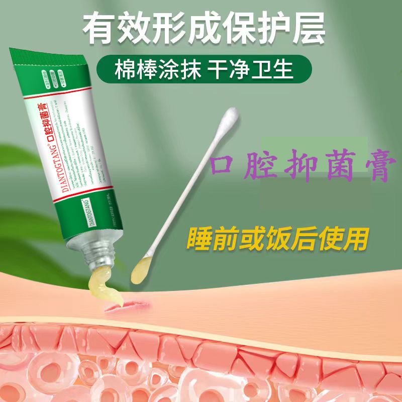 Oral Ulcer Cleaning and Removal of Mouth Ulcers for Adults and Kidsren with Sores and Blisters Oral Care Antibacterial Cream Gdiantogtang