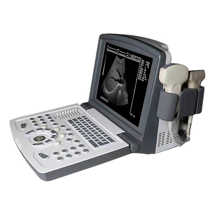 Hospital Equipment B-Ultrasound Machine Manufacturer Price B-Ultrasound Machine B-Ultrasound Color Ultrasound Equipment Manufacturer
