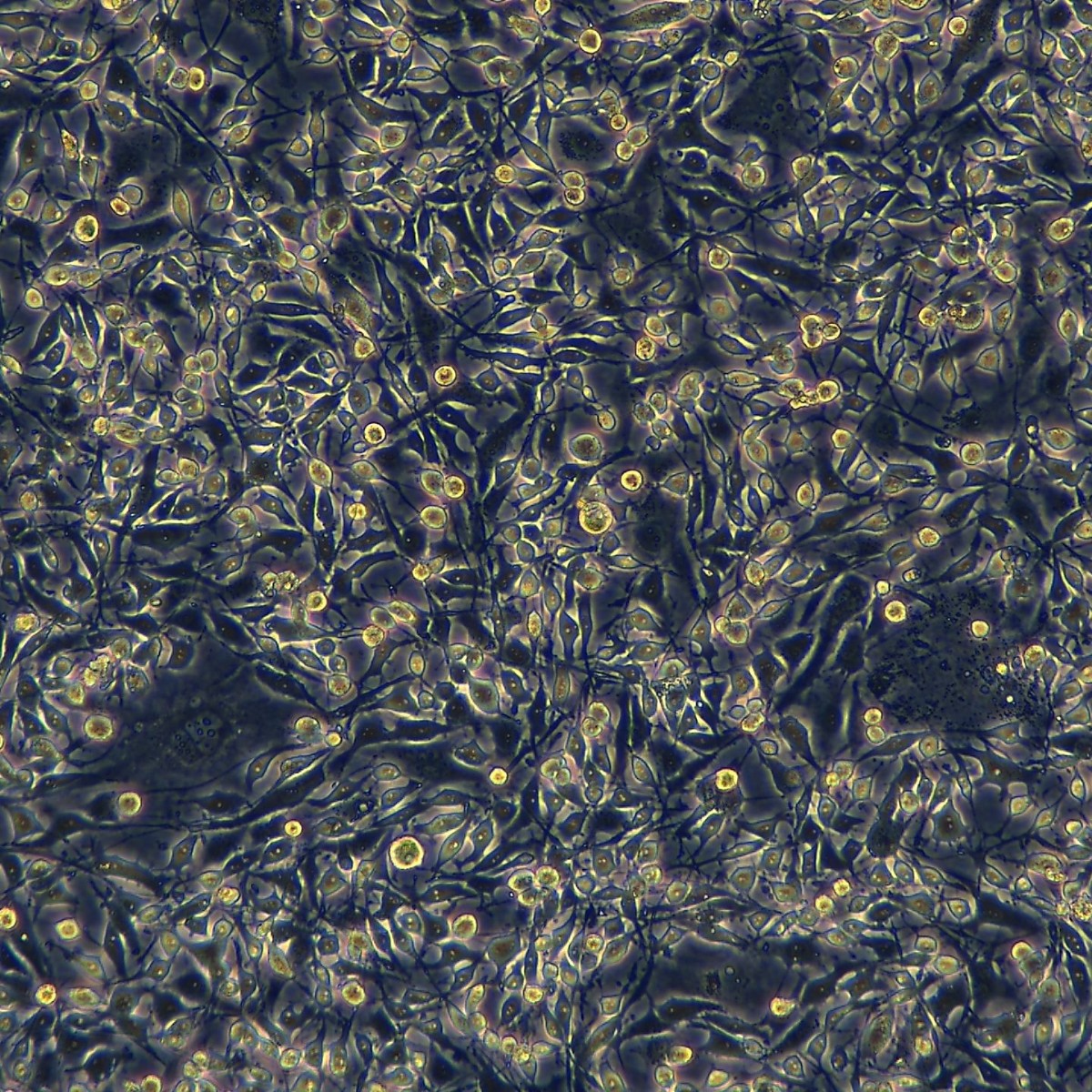 Meisen Ctcc Meisen яичниковая аденокарцинома ясноклеточного типа, штам, устойчивый к цисплатину Es-2/Ddp