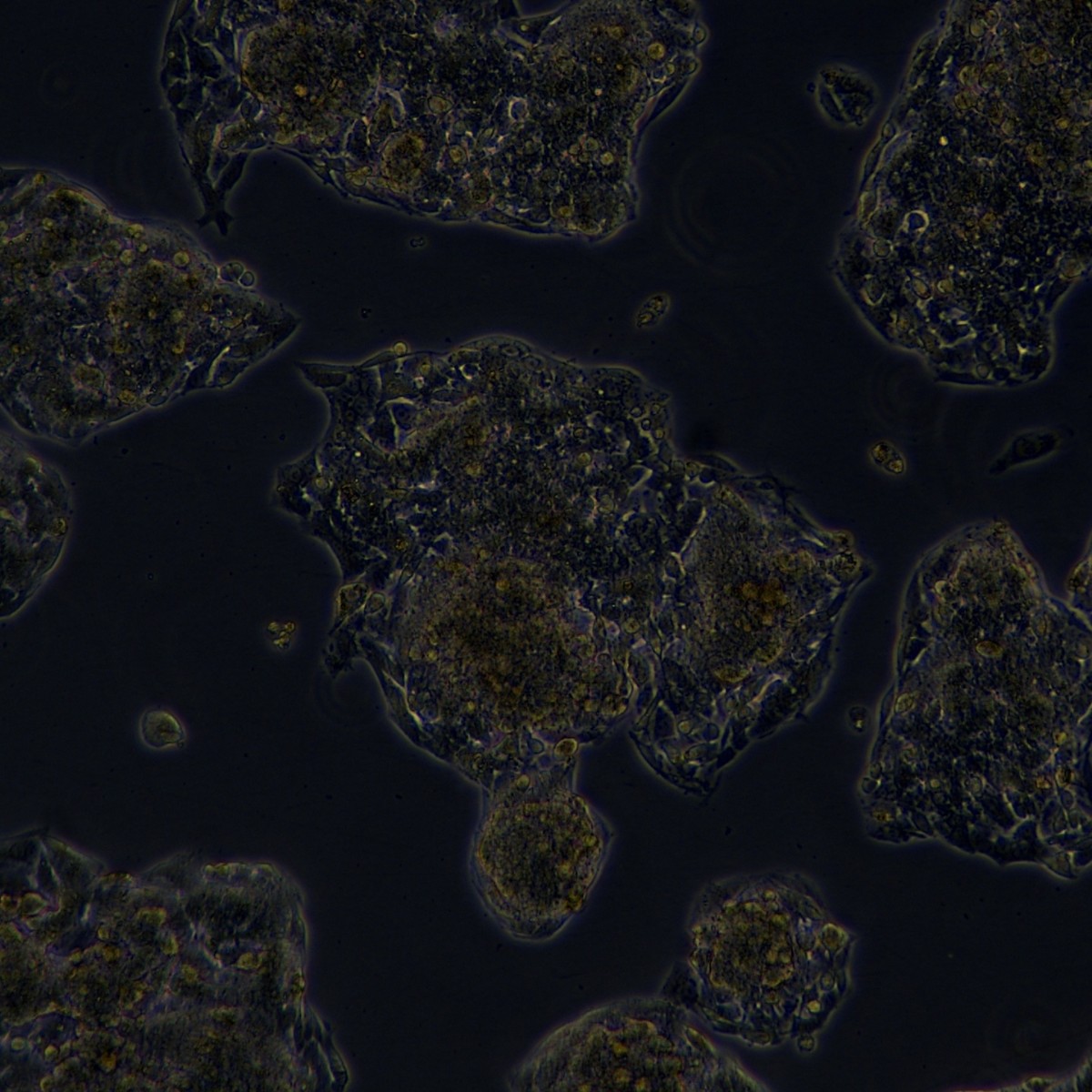 Meisen Ctcc Meisen Human Liver-Cancer Sorafenib Resistant Strain Hepg2/Sorafenib