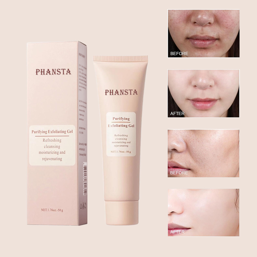 Cross-Border Spot Exfoliating Facial Exfoliating Pore Cleaning Gel