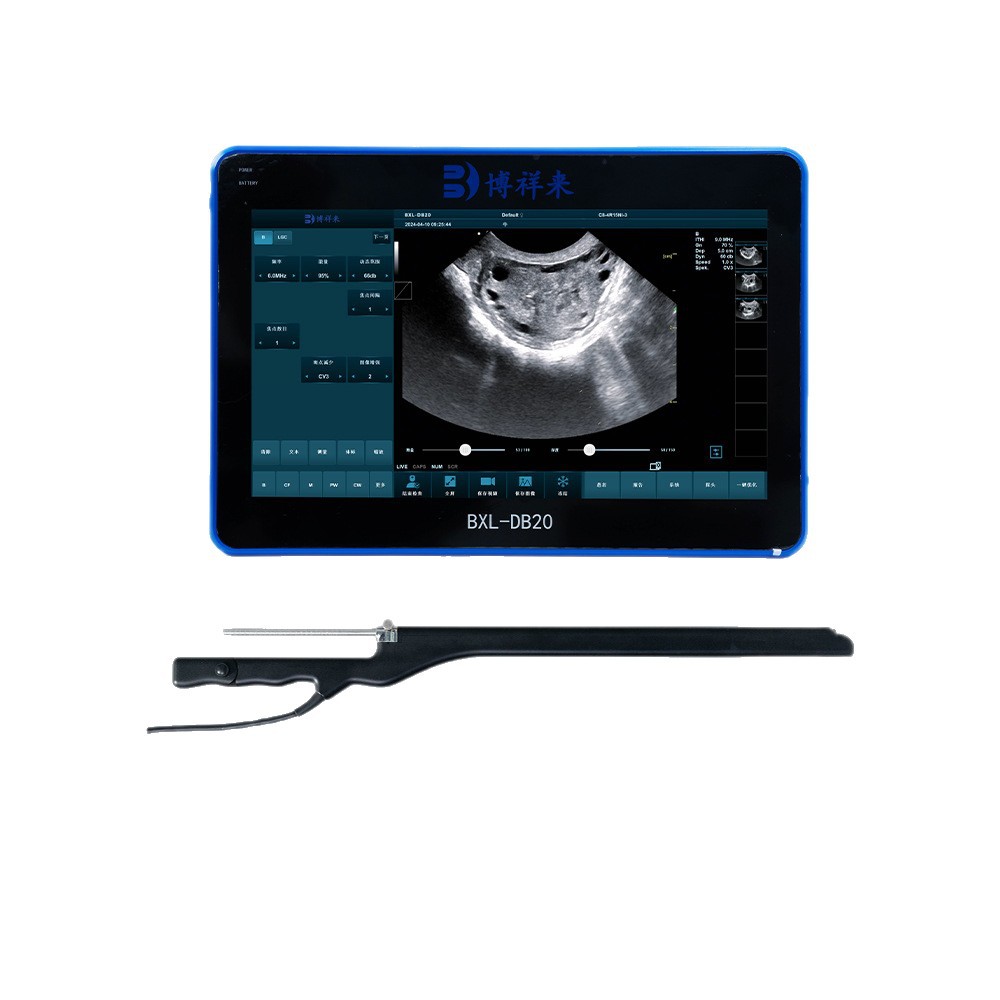 Domestic Live Ovary Collection Device for Cattle, Cattle and Horse Ovary Collection B-Ultrasound Machine, High-Definition 128-Element Probe Opu Ovary Collection Equipment
