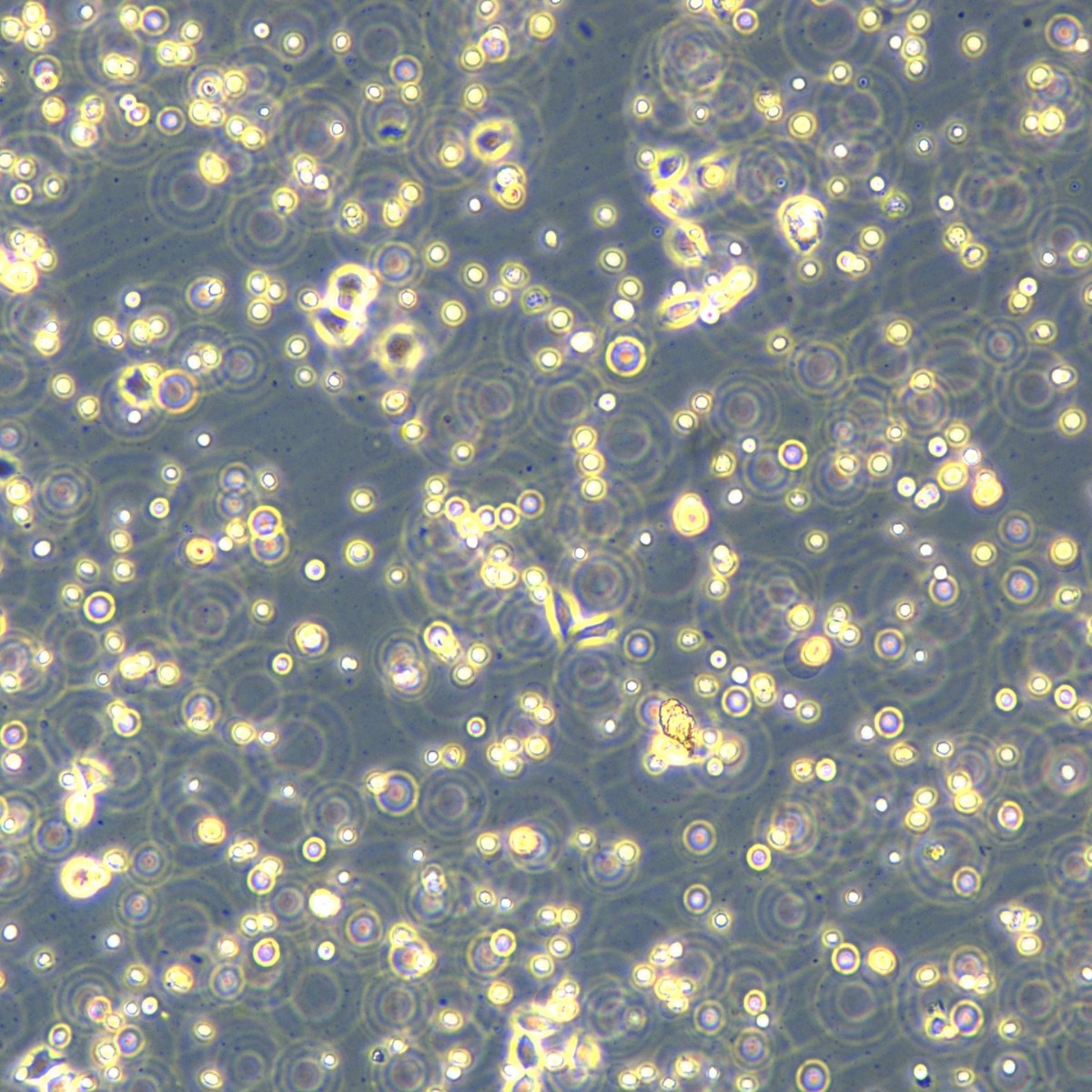 Meisen Ctcc Meisen Human Low-Differentiated Lung Adenocarcinoma Cells Sk-Lu-1