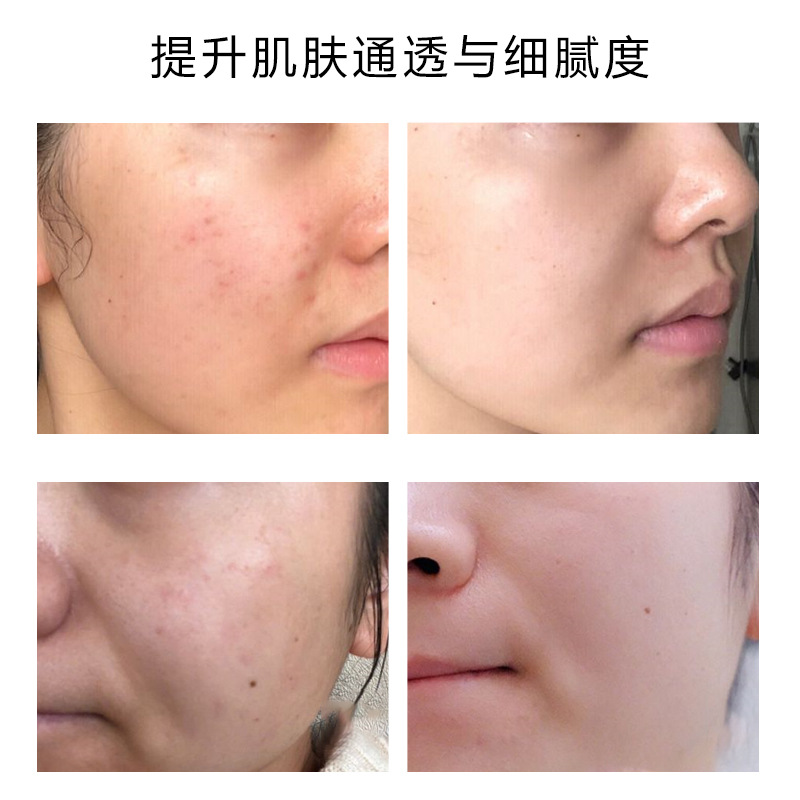 Shake the sound with the left-handed VC essence tablet left-handed vitamin C essence tablet brightening and tender skin solid essence tablet freeze-dried tablet powder