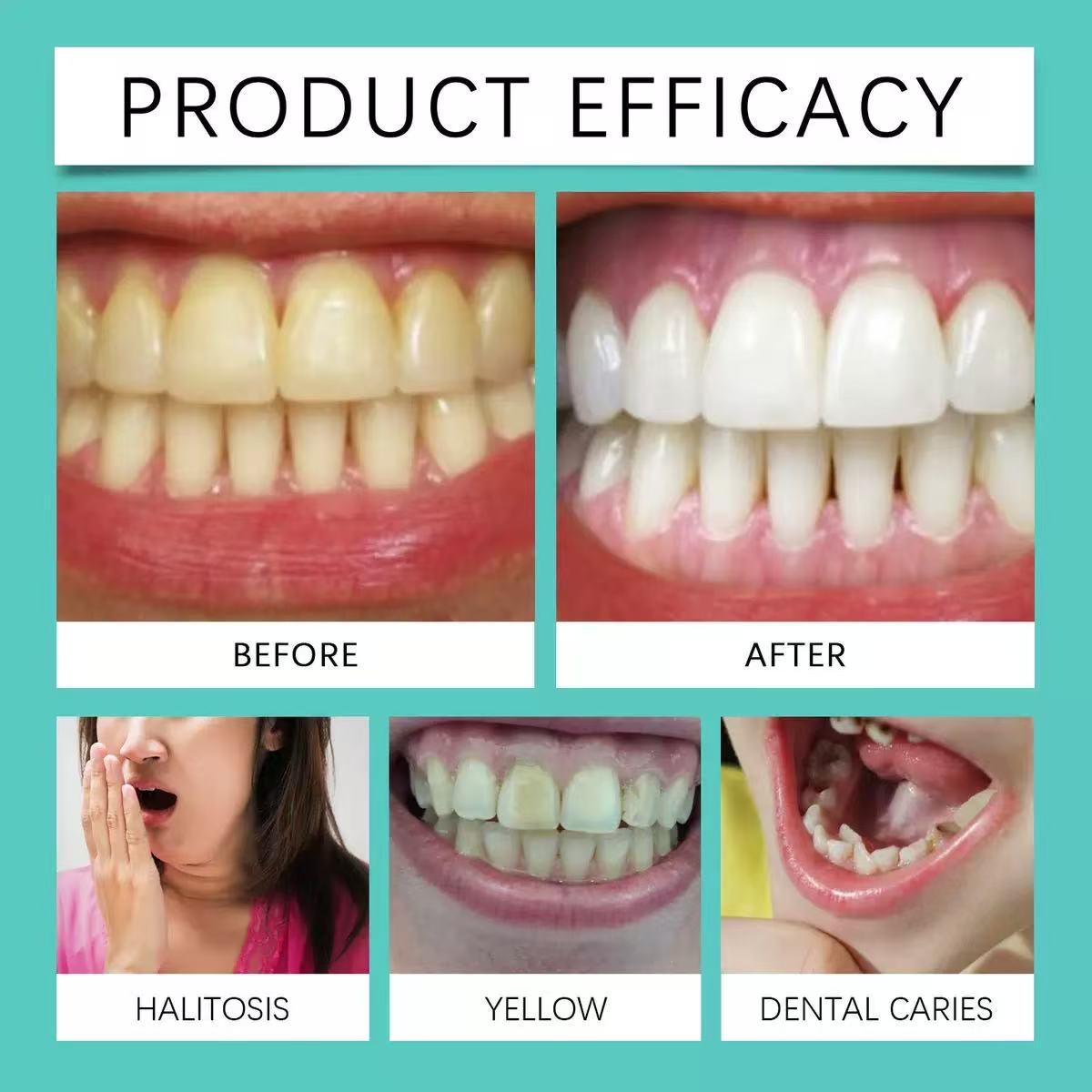 Kindergarten Cross-Border Hot Product Tooth Whiteningstrip Coconut Oil Tooth Care Tooth Whitening Patch Tooth Whitening Strip