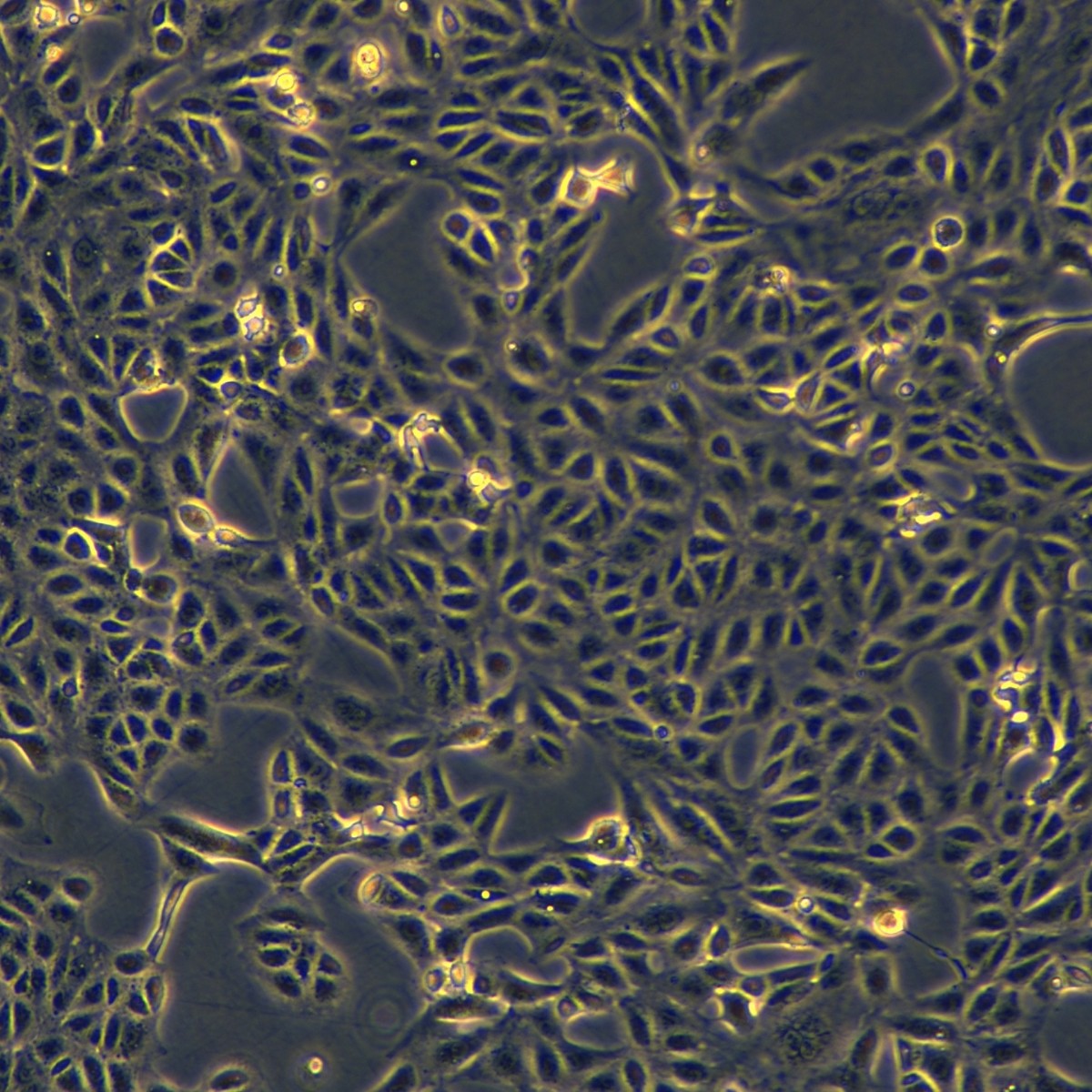Meisen Ctcc Meisen Human Renal Cell Adenocarcinoma Sorafenib Resistant Strain Achn/Sorafenib