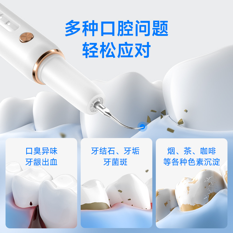 Manufacturer Wholesale Yue'Erwanwan Ultrasonic Tooth Cleaner for Removing Tartar, Dental Scaler for Cleaning Teeth, Tooth Stain Remover