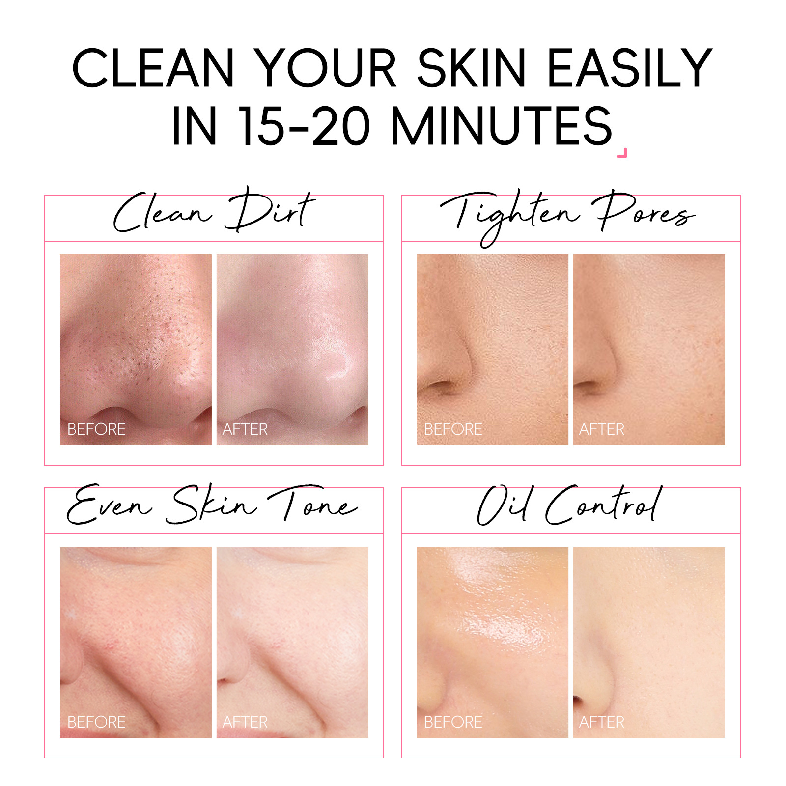 Temu Version Laikou Laikou Cherry Blossom Peel-Off Mask 50g (Tose) Cleans Pores Export Facial Mask Skin Care