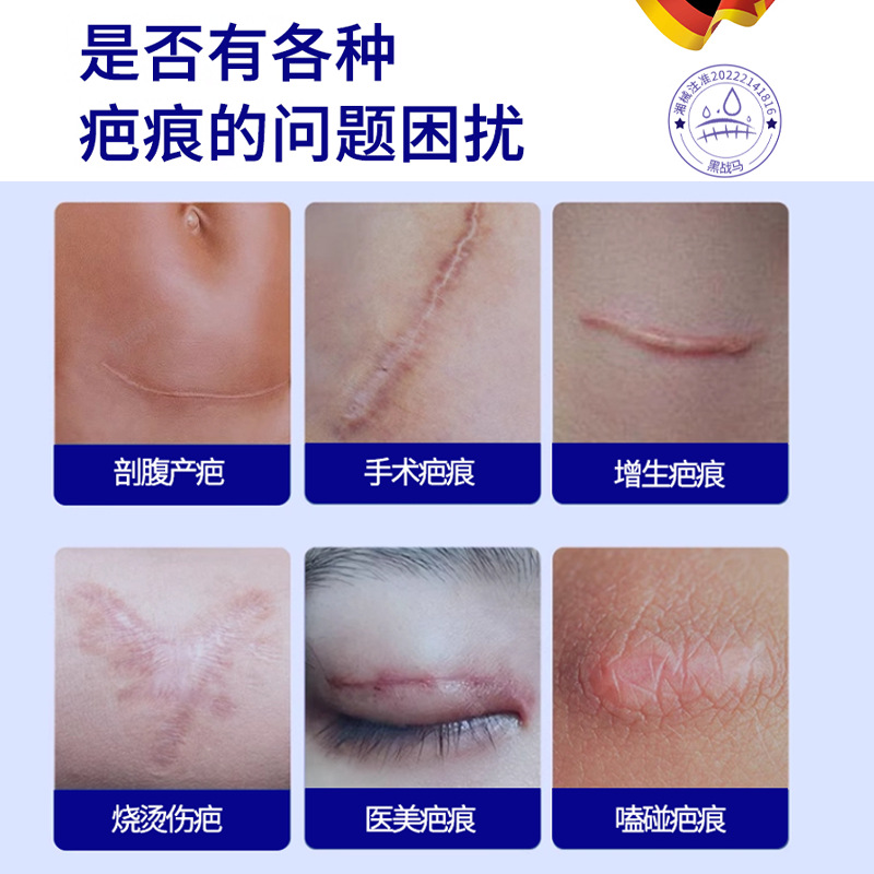 Light Scars, Scalds, Caesarean Section Scars, Skin Moisturizing, Repairing Dry Cracked Scores, Wound Scars, Gel, Genuine Wholesale