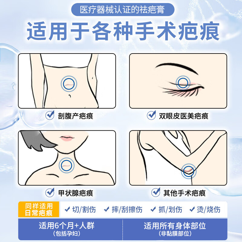 Hongyi Customer-Specific Link