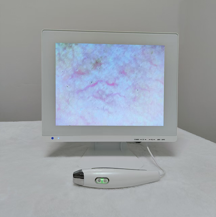 15inch Three-Spectrum Skin Detector Hair Follicle and Pore Testing Machine Epidermis and Dermis Pore Blockage Detection