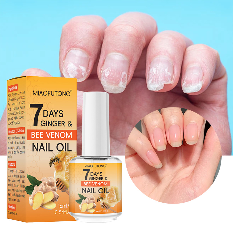 Эксклюзивное предложение на 7 дней, масло с куркумой и пчелиным ядом для пальцев и ног, питательное решение для кутикулы