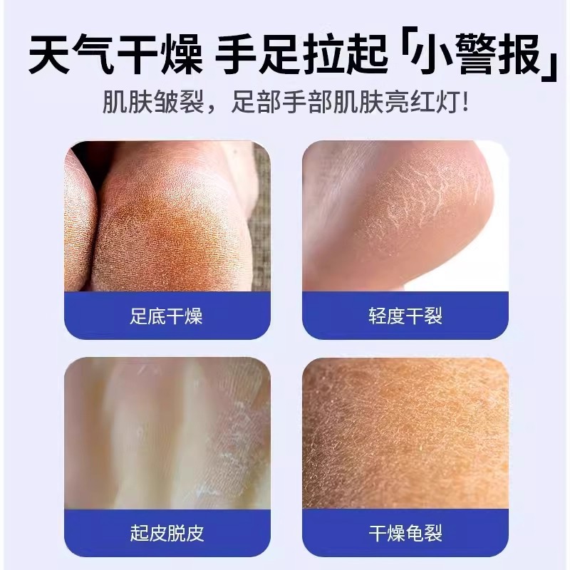 Japanese Chapped Cream for Dry and Cracked Heels, Moisturizing and Anti-Cracking Cream for Chapped Hands and Feet, Gel Hand Cream