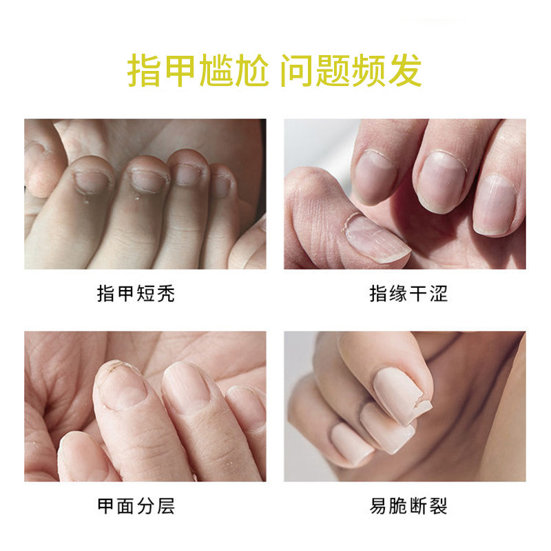 Finger Edge Oil Factory Cosmetics Factory Nail Polish Nail Polish Anti-Hangnail Exfoliation Nail Edge Care Cream