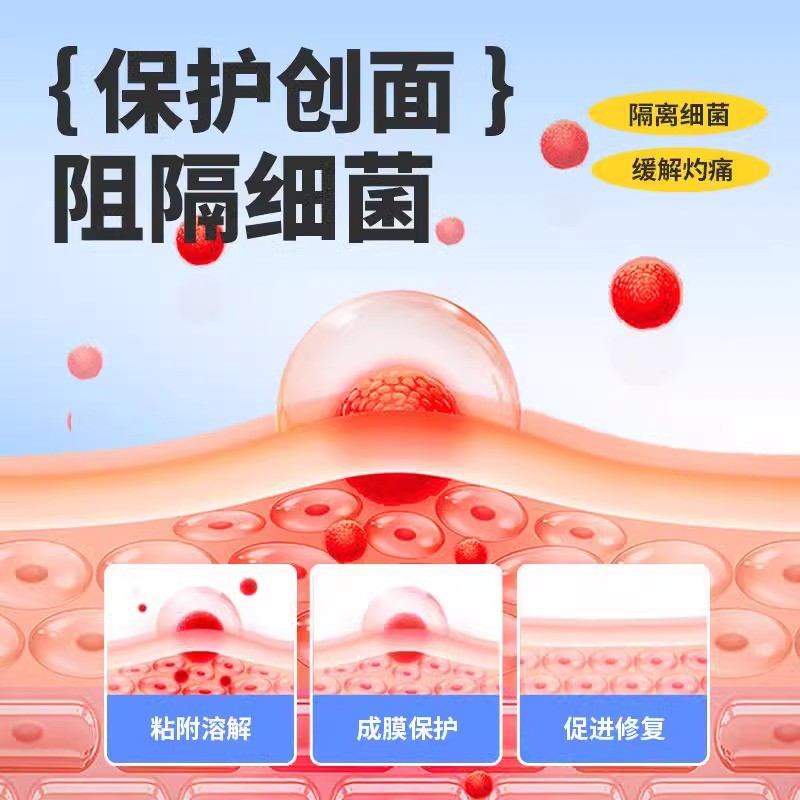 Renhe Oral Ulcer Film, Oral Ulcer Heat Clearing and Shortness of Breath, Suitable for Painful Mouth and Tongue Pain, Wholesale Delivery 1 2 Tablets Per Box