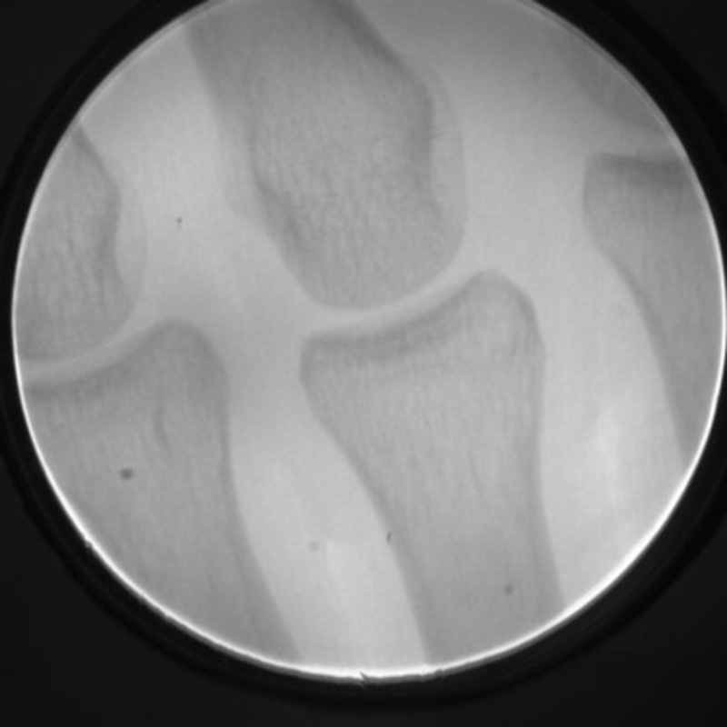 Portable X-Ray Machine Orthopedic Fluoroscope Pet Radiography Digital Circuit Board Chip Industrial Inspection Flaw Detection X-Ray