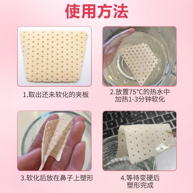 Thermoplastic nasal splint nose after rhinoplasty nose fixator nose bridge becomes stiff self-kneading shape shrink nose wing anti-picking nose artifact