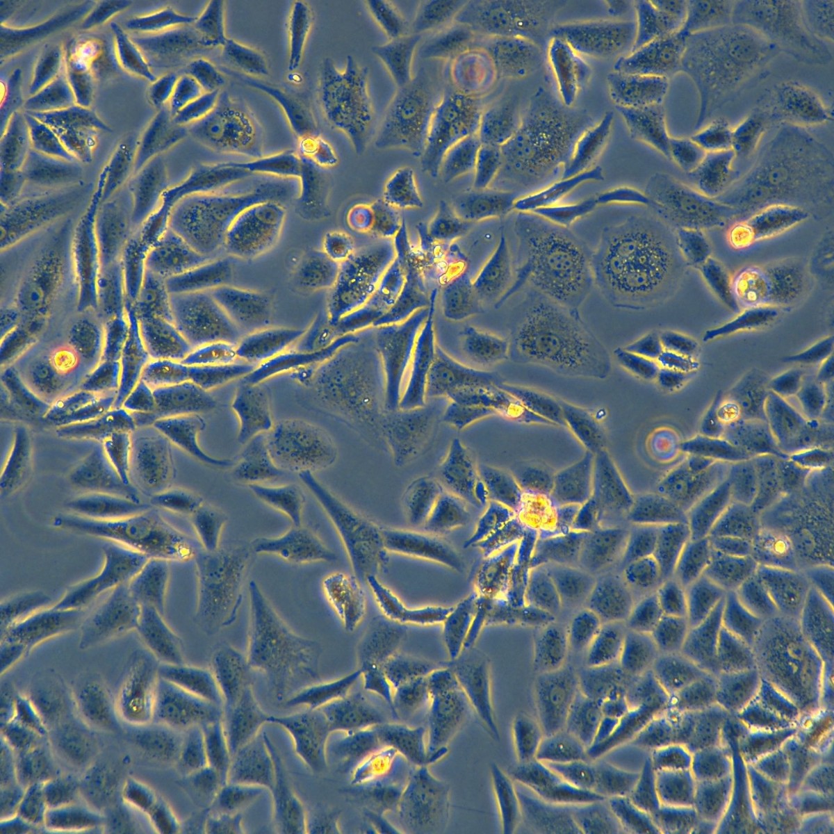 Meisen Ctcc Meisen Human Low-Differentiated Lung Adenocarcinoma Cells Sk-Lu-1