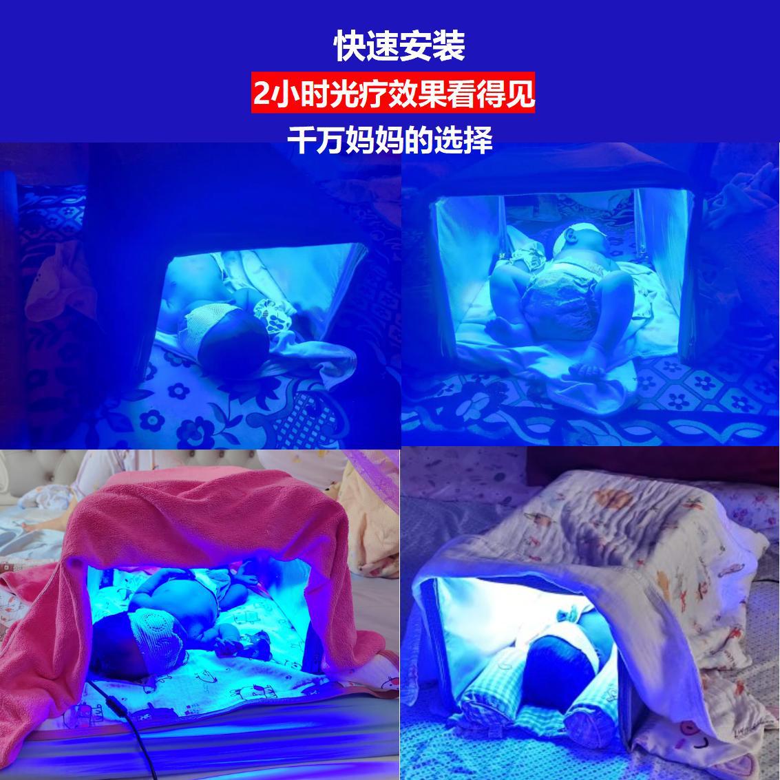 Ядерный синий световой ящик новорожденного фототерапия синий световой ящик детектор желтухи до желтухи синий световой ящик
