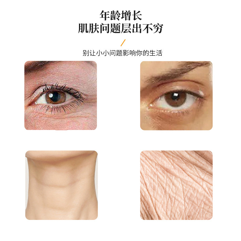 Haiti 1.5 Panda Filler for Neck Wrinkles, Dark Circles, Tear Troughs, Fine Lines, Non-Cross-Linked Composite Hyaluronic Acid Injection