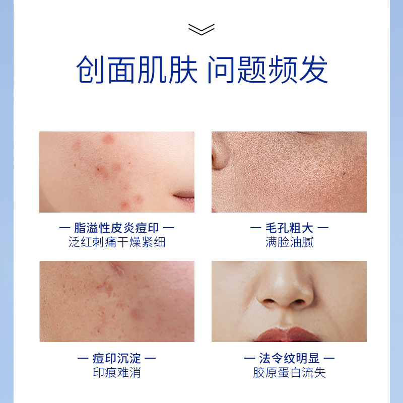 Price Change after Purchase】Shunaimei Medical Recombinant Collagen Ointment Skin Regeneration Factor Moisturizing Repair Cream