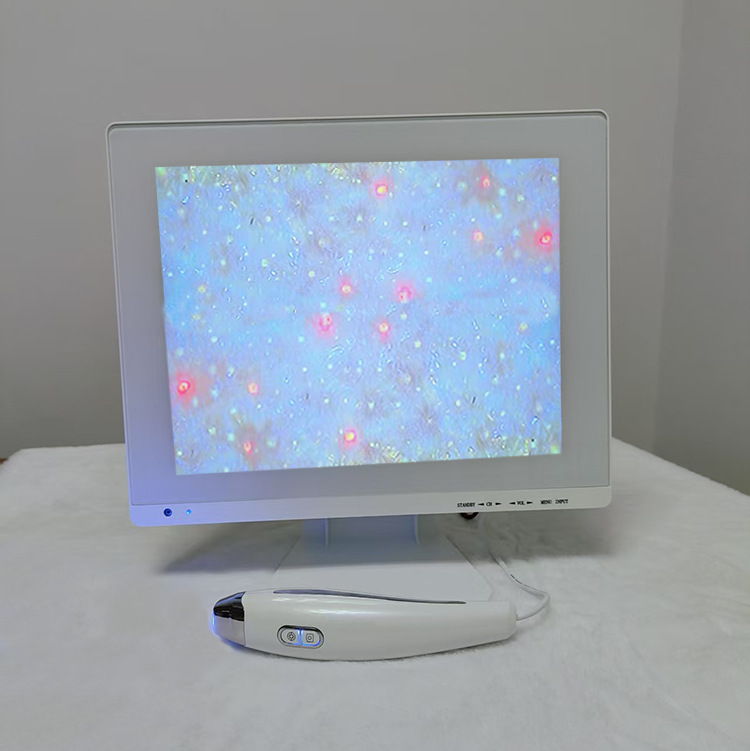 15 дюймовый трехспектральный детектор кожи машина для тестирования фолликулов волос и пор эпидермис и дерма детекция заблокированных пор