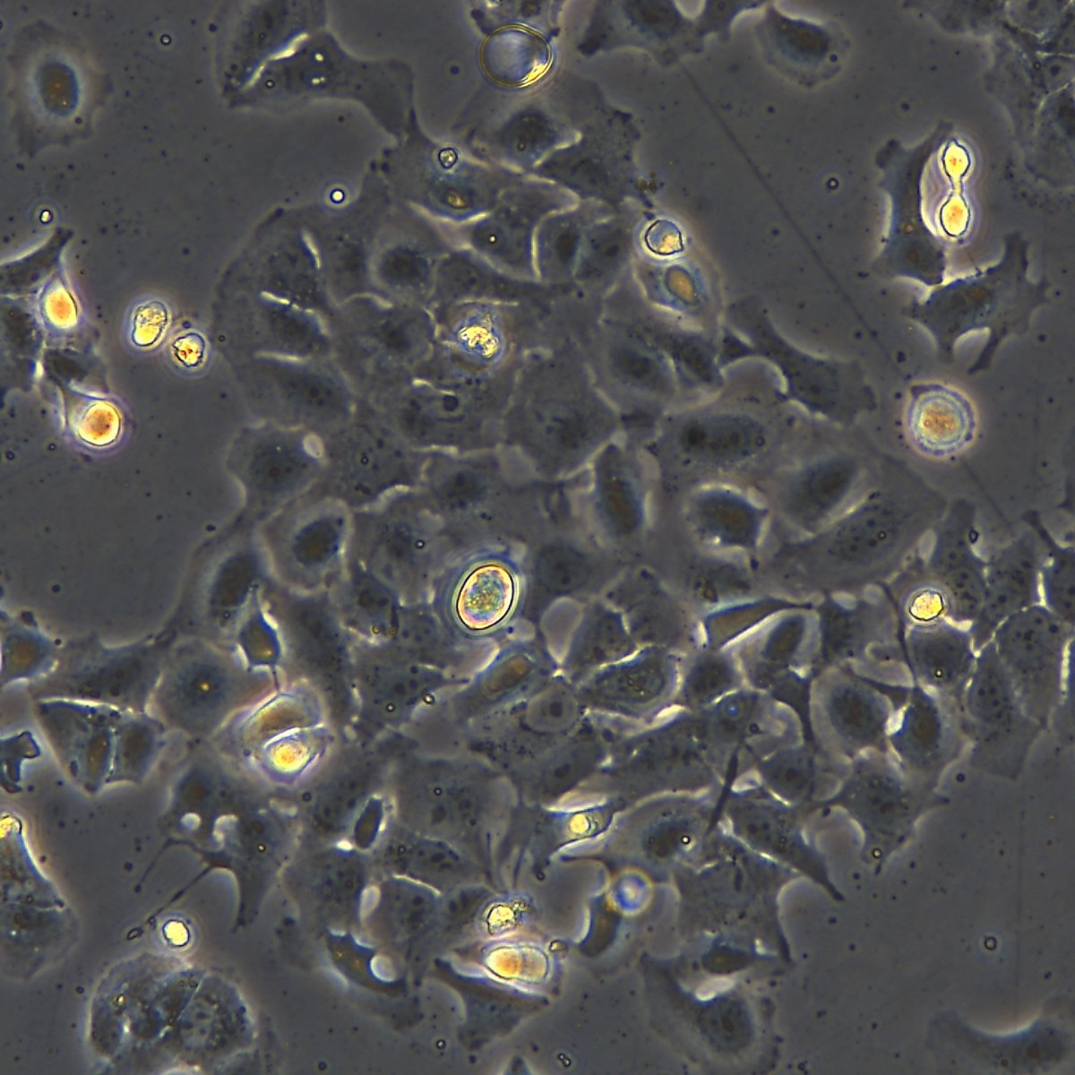 Meisenctcc Human Ovarian/Cancer Cisplatin-Resistant Strain Caov-3/Ddp