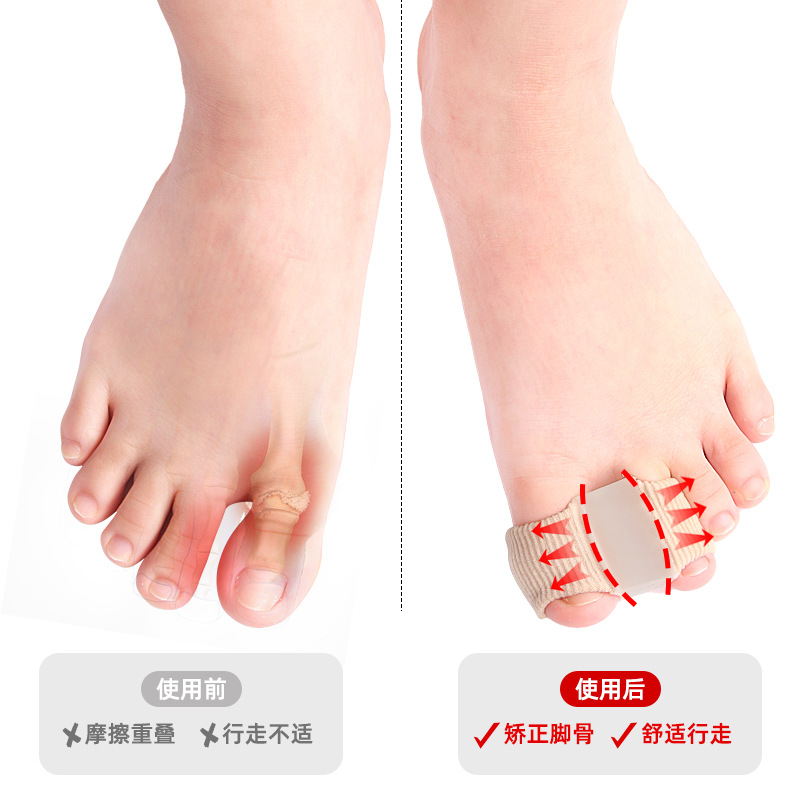 Cross-border toe splitter thumb valgus big toe bone overlap toe separator men's and women's fiber double hole set orthosis