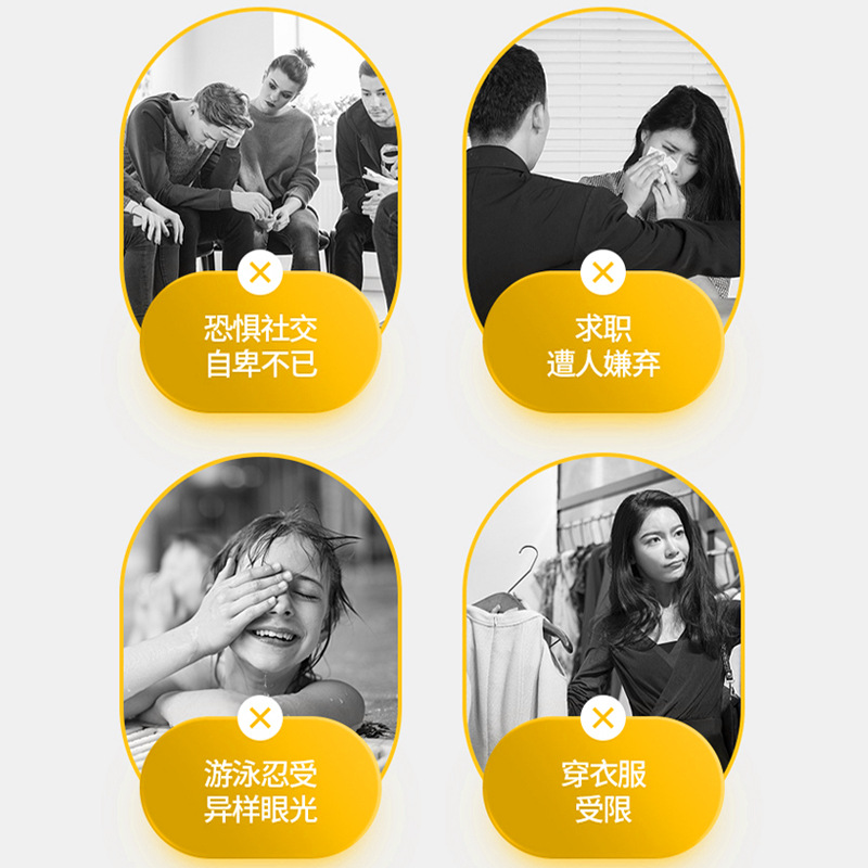 Sunflower Medical Silicone Scar Gel for Skin Damage, Burns, Scar Removal, Post-Surgery Scar Repair Cream