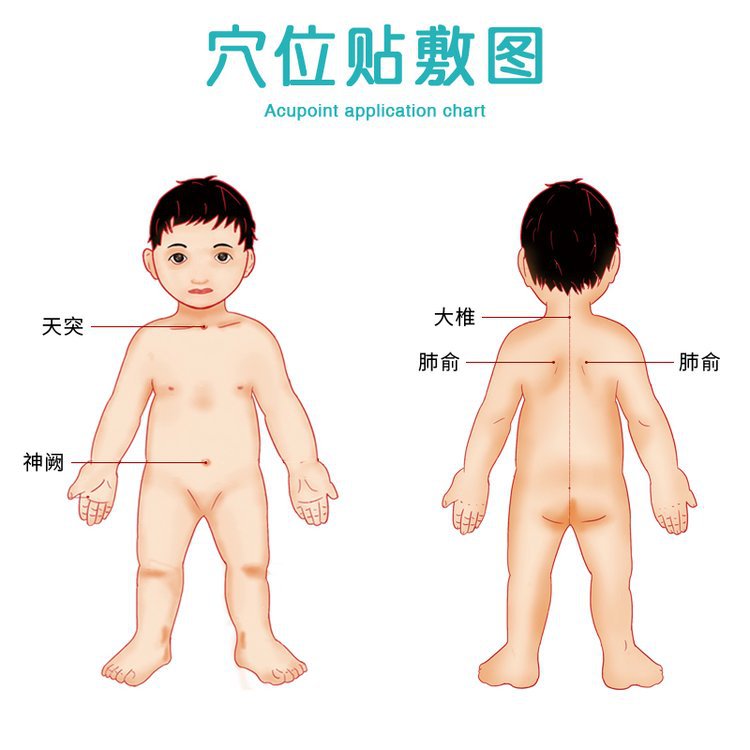 Jingtiantang Cold Patch Acupoint Pressure Stimulation Patch Bidding Hanging Net Zhu's Pharmaceutical Mud Patch Manufacturer Wholesale Agent