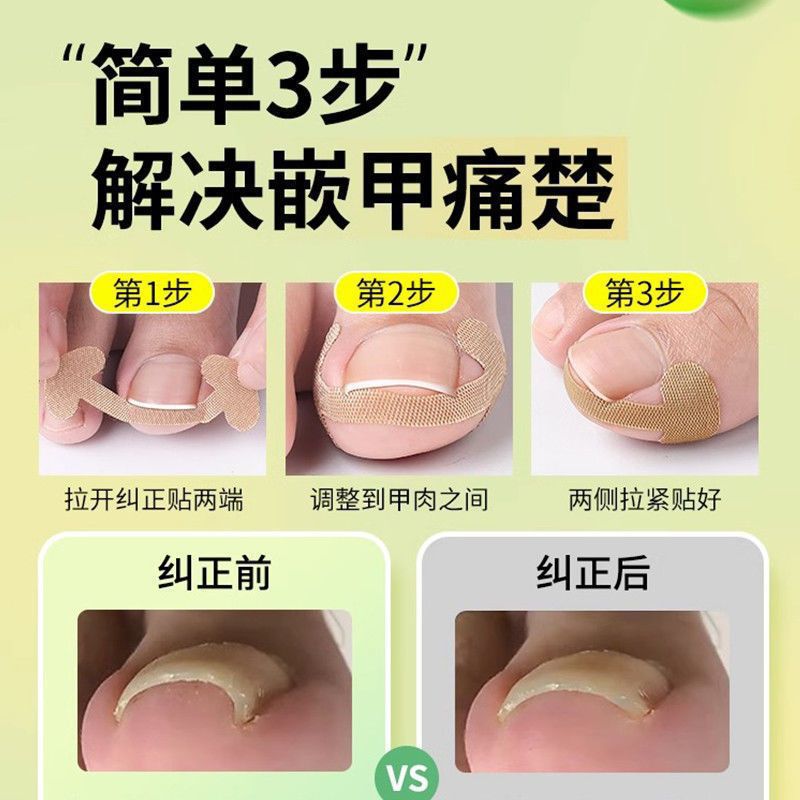 Glue-free nail sticking nail groove nail correction toe nail nail nail patch Lala manicure factory goods