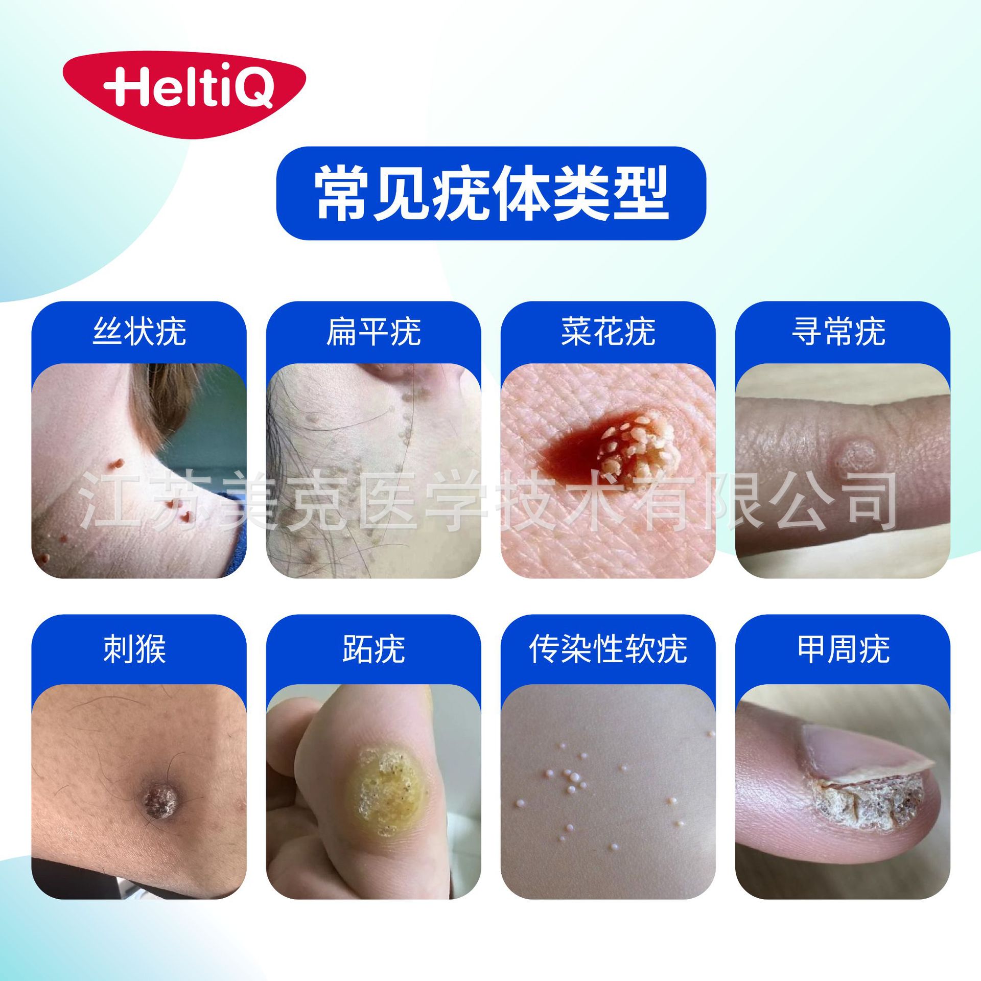 Hodyou Frozen Wart Removal Spray Type Ii Device Non-Medical Liquid Nitrogen Gel to Remove Warts Filamentous Warts Flat Warts Plantar