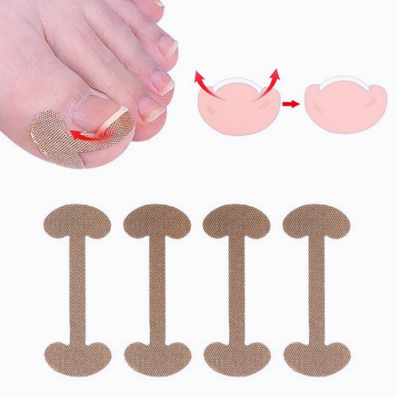 Cross-border Explosions Nail Repair Correction Lala Sticker Nail Correction Patch Nail Inlay Correction Patch Lala Sticker Free Paste Correction