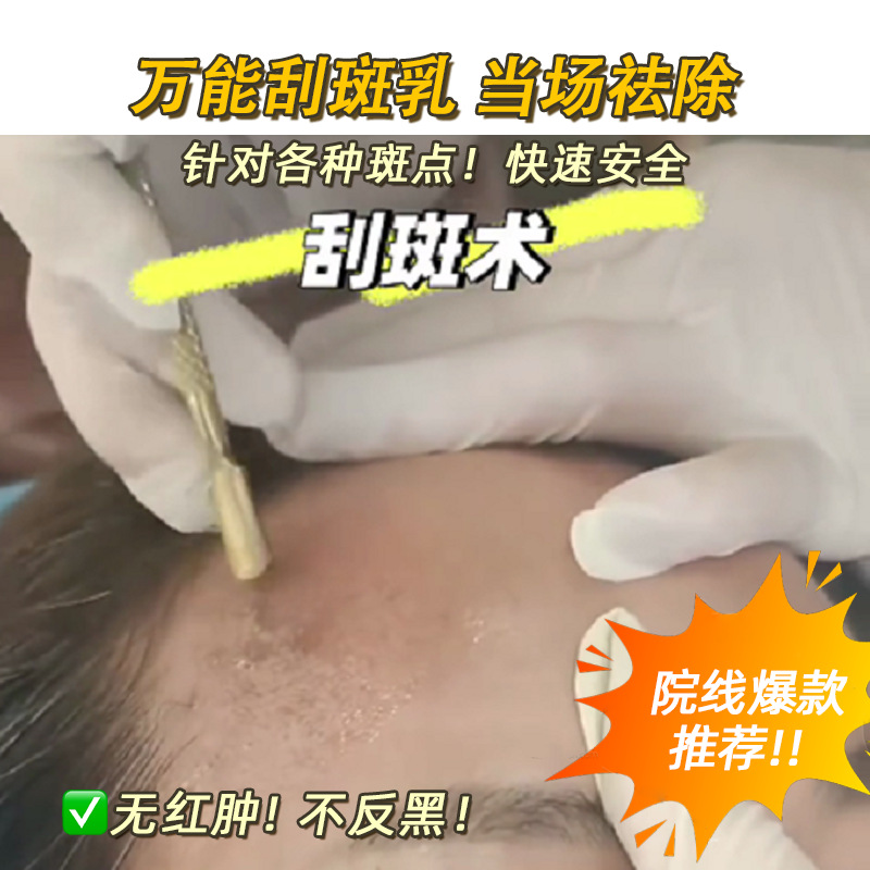 Spot Scraping Emulsion Spot Removing Essence Emulsion Plain Skin Bulb Skin Whitening Spot Removing Spot Revitalizing and Dissolving Spot No Embarrassment Non-anti-black Beauty Salon