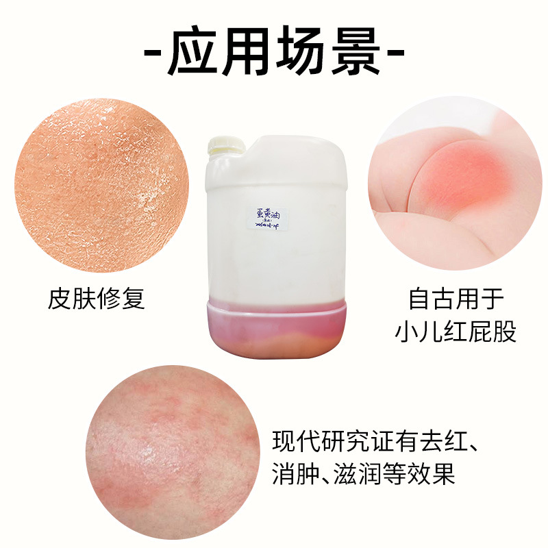 Progestrone-Free Egg Yolk Fine Chemical Product for Repairing and Protecting Red Buttocks