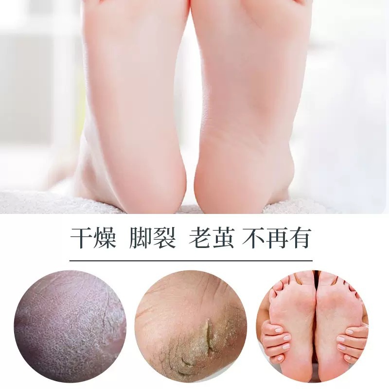 Real White Chamomile Vitamin E Foot Cream Anti-Crack Cream Autumn and Winter Hand and Foot Care Soothing Moisturizing Anti-Crack Cream