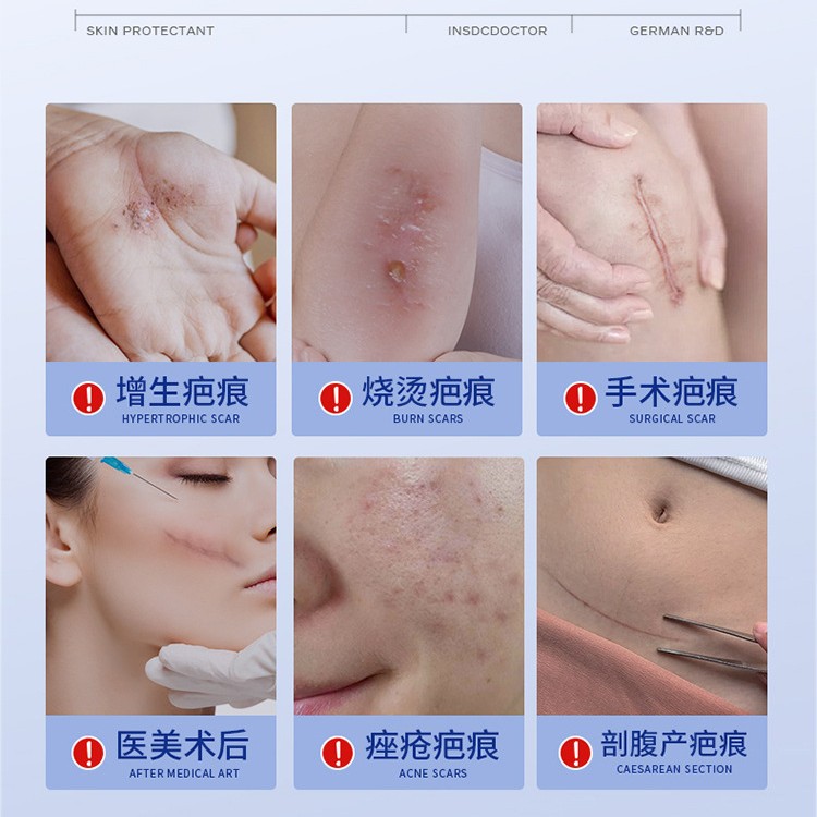 Dexi Scar Gel Postoperative Postpartum Hyperplasia Scar Repair Medical Source Factory Odm Processing Oem