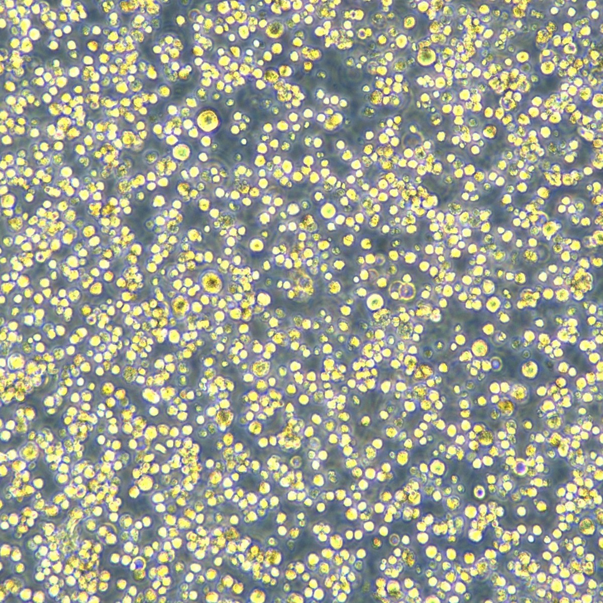 Meisen Ctcc Chronic Myeloid Leukemia/Illness Imatinib Resistant Strain K562/Imatinib