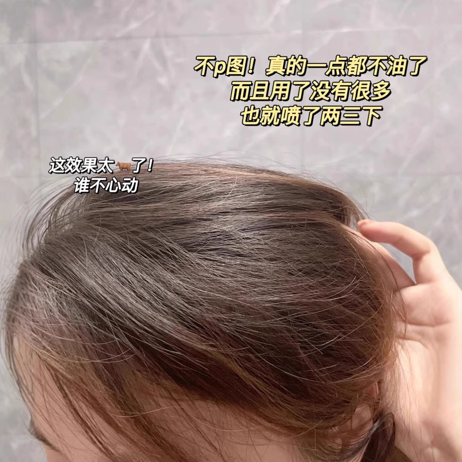 Spes Dry Hair Spray Spes No-Wash Spray to Remove Hair Oil and Oil Control Artifact Dry and Fluffy Powder