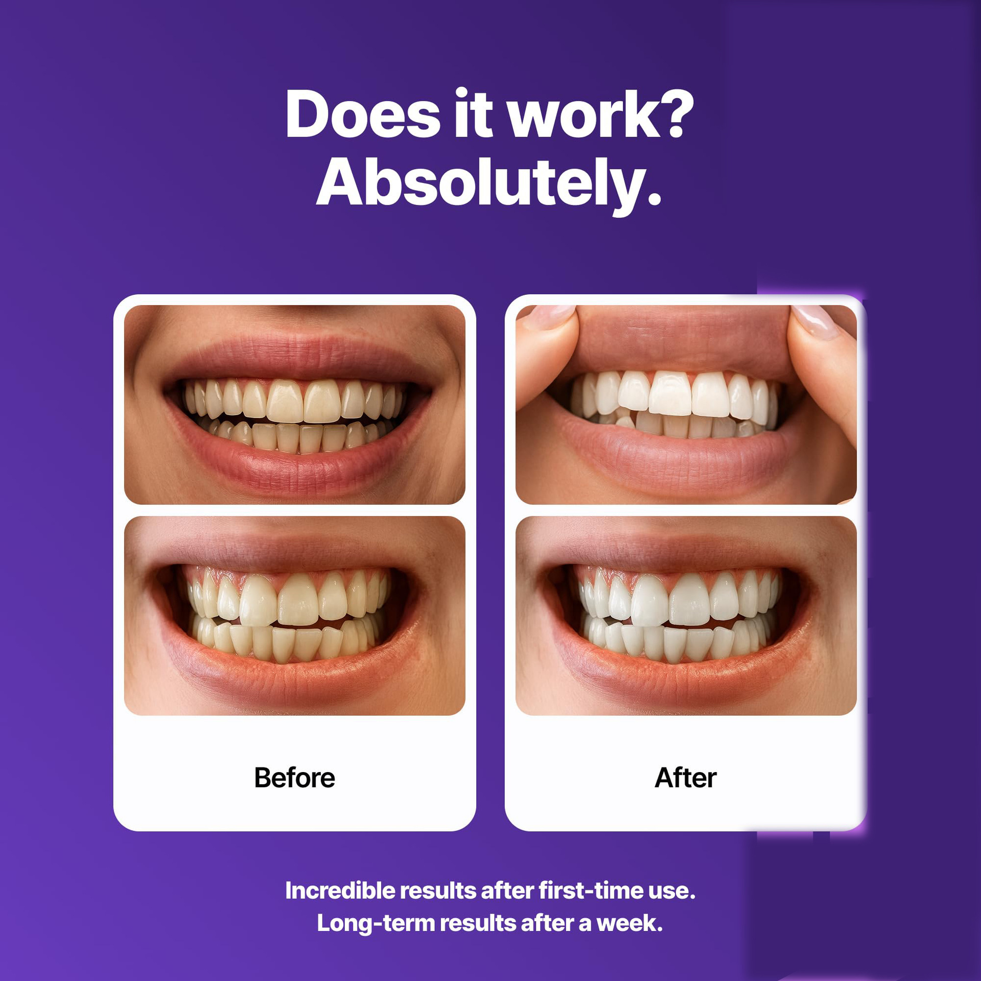 Dr. Dent Purple Teeth Whitening Strips Protects Tooth Enamel Layer Teeth Strips