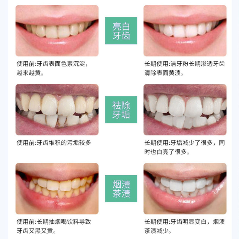 [in stock] Dr. Homei Probiotics Dazzling White Tooth Powder to remove Tooth Stains, Brightening White and Fresh Breath Probiotics Dental Powder