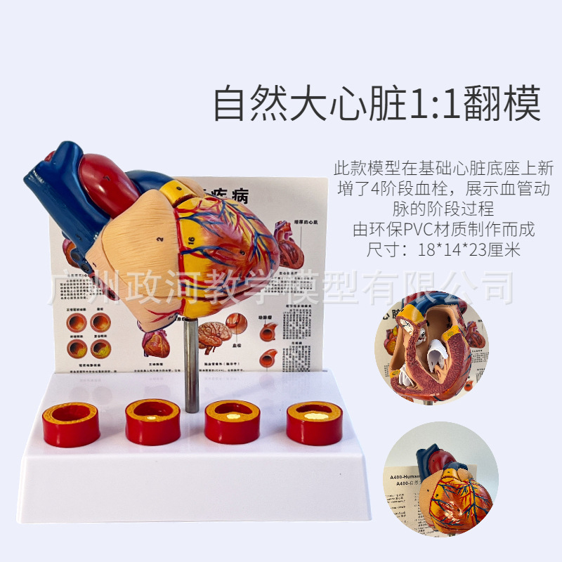 Standard Human Heart Model, Anatomical Detachable Teaching Artificial, Natural Large Heart with Blood Clot Blood Vessel Model