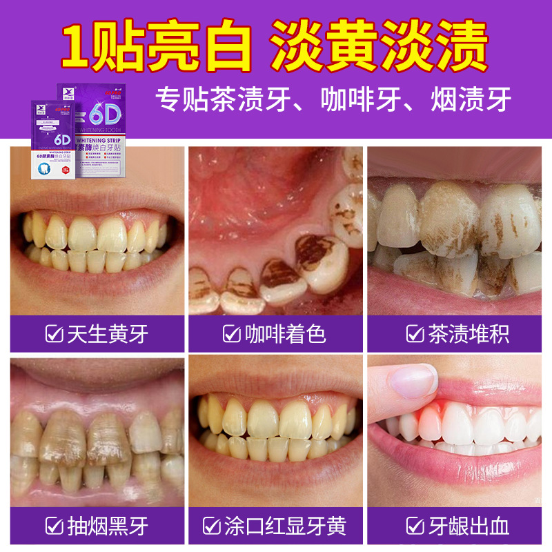 Brightening Teeth Strips Reduce Yellow Stains, Whitening Tooth Mask, Teeth Whitening Strips, 7 Pairs, 14 Pieces, Wholesale